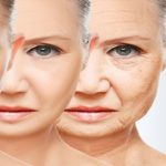 Antiaging